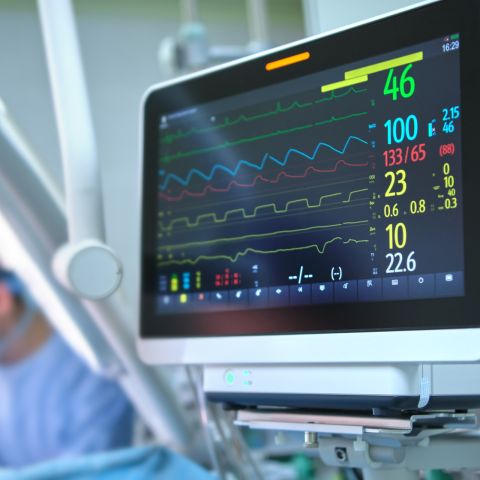 Heart rate monitor in hospital operating theatre
